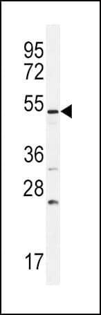 ALK-6 / BMPR1B Antibody (aa134-162)