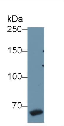 F8 / FVIII / Factor VIII Antibody (aa1854-1989)