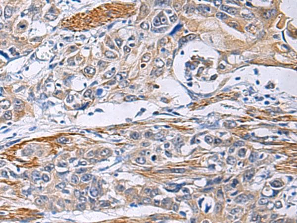 FBXO45 Antibody