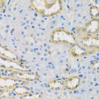 Polyclonal Rabbit anti-Human HS1BP3 Antibody (IHC, WB)