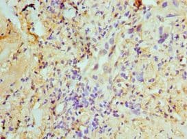 Polyclonal Rabbit anti-Human U2AF1 Antibody (aa1-240, IHC)
