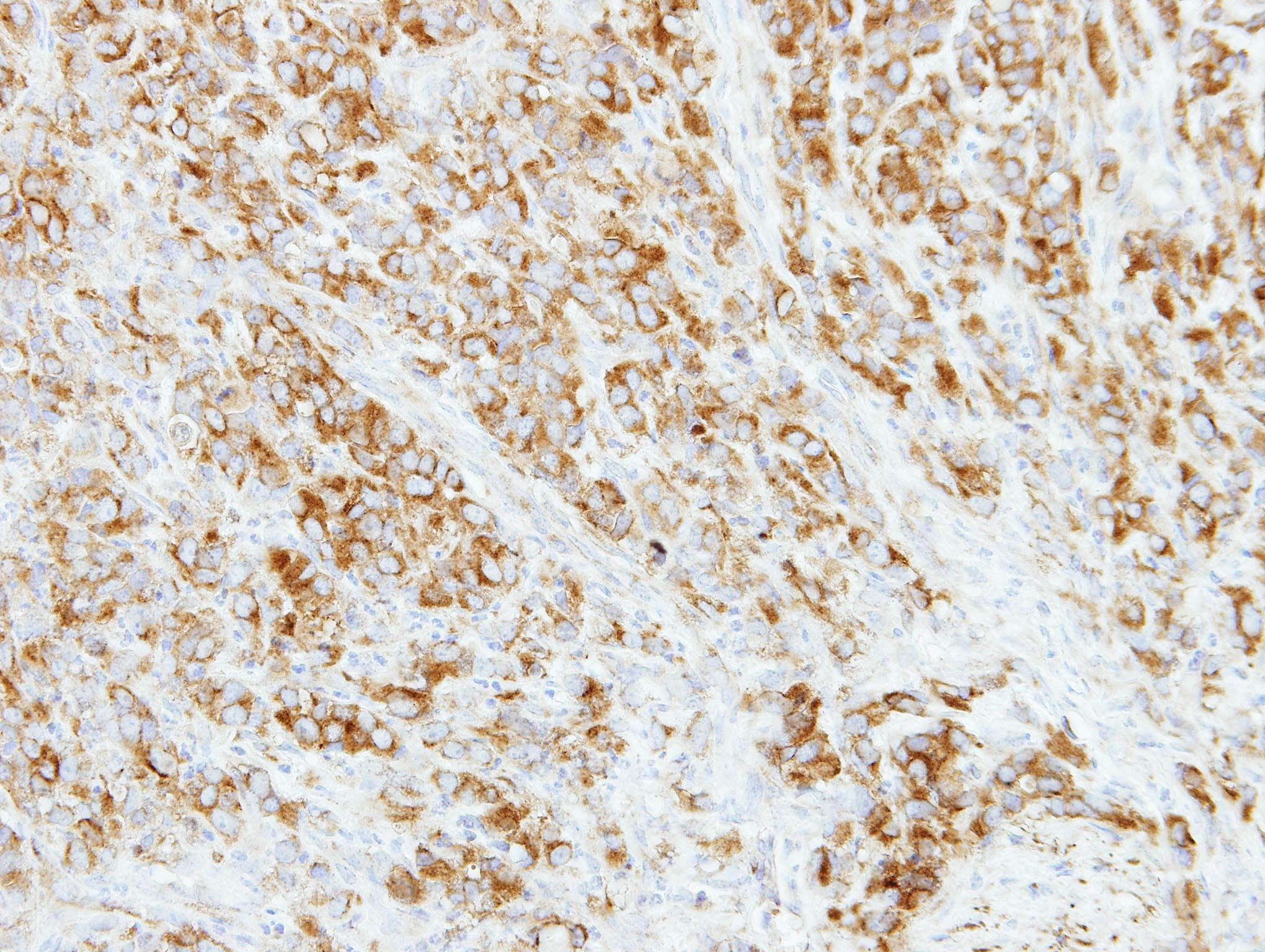 AP4M1 Antibody (aa70-295)