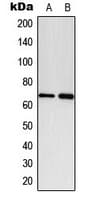 Polyclonal Rabbit anti-Human PXN / Paxillin Antibody (phospho-Tyr118, WB)