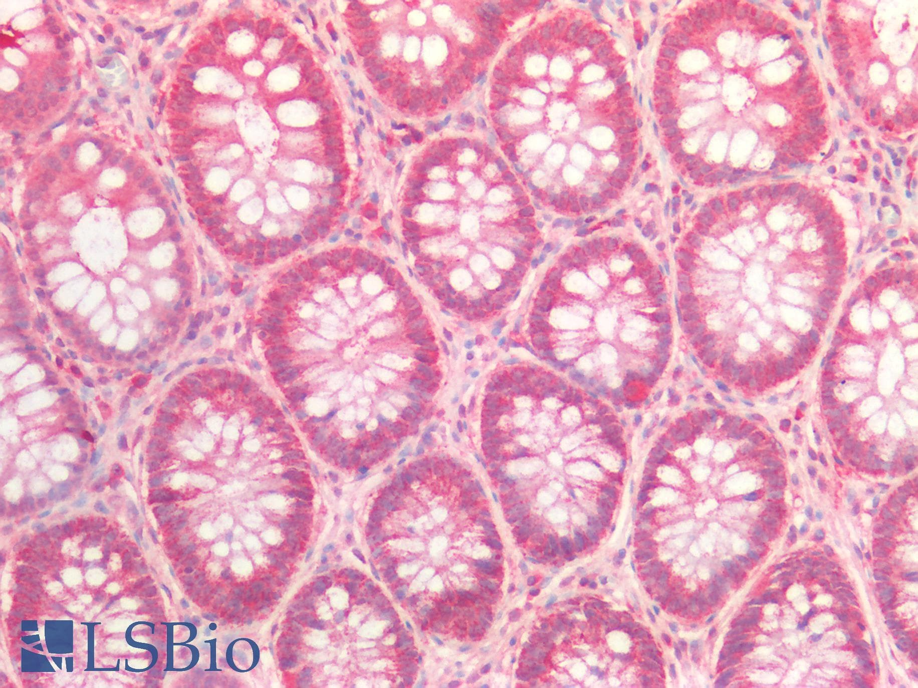 PathPlus™ MLPH / Melanophilin Antibody