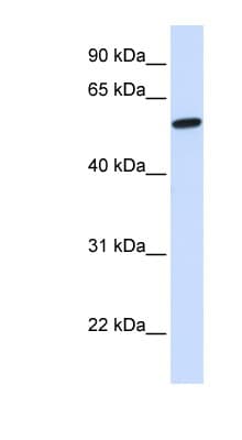 Polyclonal Rabbit anti-Human NSMF / NELF Antibody (N-Terminus, WB)