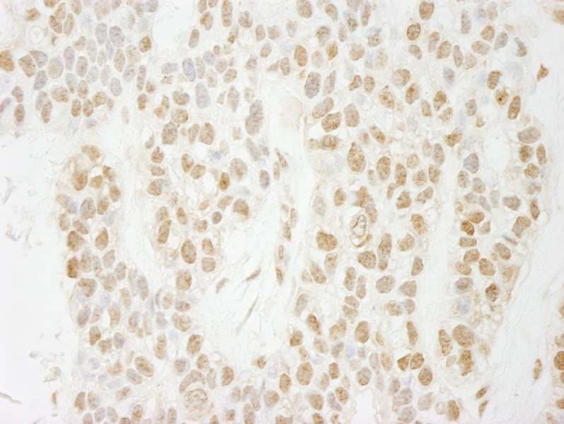 Polyclonal Rabbit anti-Human PAGR1 / C16orf53 Antibody (aa204-254, IHC)