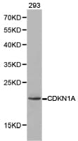 Polyclonal Rabbit anti-Human CDKN1A / WAF1 / p21 Antibody (IHC, WB)