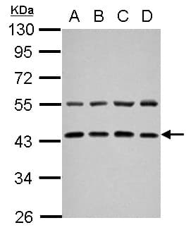ZFYVE27 / Protrudin Antibody