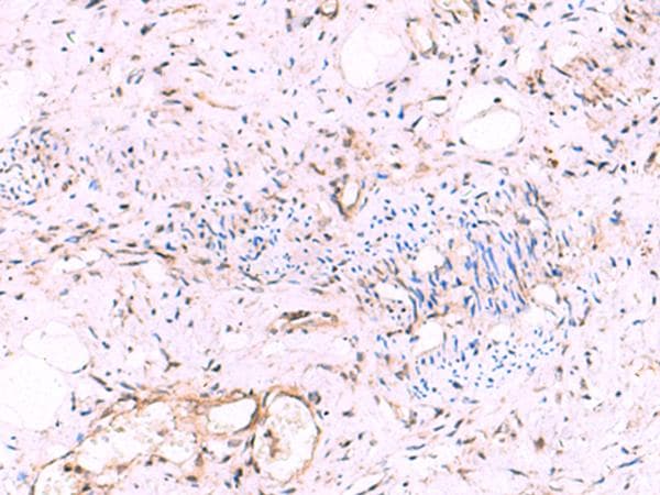 Polyclonal Rabbit anti-Human KATNAL1 Antibody (IHC)