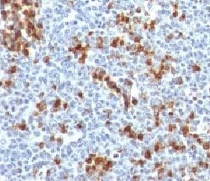 Mouse Anti-Human Kappa Light Chain Secondary Antibody (clone KC3L-1)