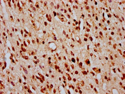 HIST1H2BN Antibody