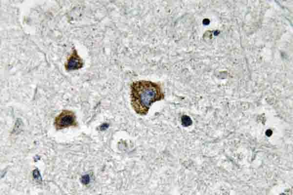Polyclonal Rabbit anti-Human NIP3 / BNIP3 Antibody (Glu96, IHC, WB)
