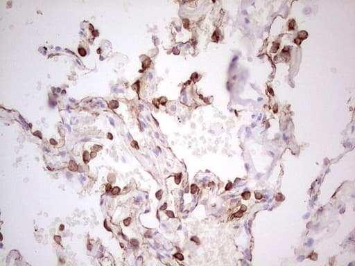 ABCB1 / MDR1 / P Glycoprotein Antibody (aa995-1280, clone OTI8A9, Carrier-free)