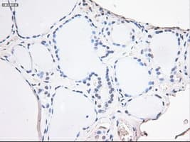 NOG / Noggin Antibody (clone OTI1C1)