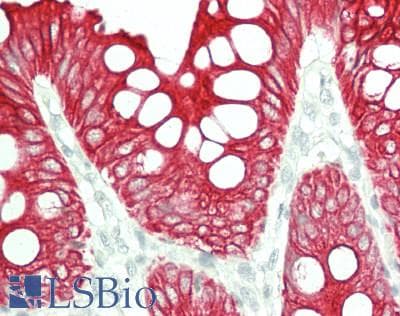IHC-plus™ Monoclonal Mouse anti-Human KRT18 / CK18 / Cytokeratin 18 Antibody (clone CK-18, IHC, WB)