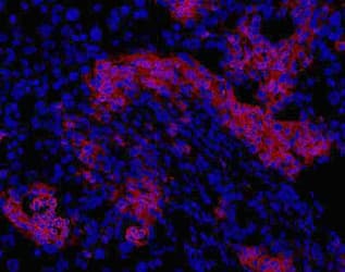 Oval Cell Marker OC2 Antibody (clone OC2-2A6)