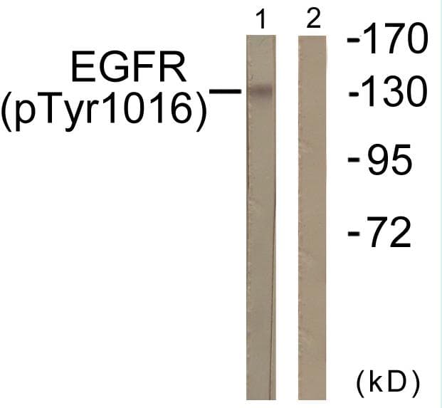 EGFR Antibody (phospho-Tyr1016)