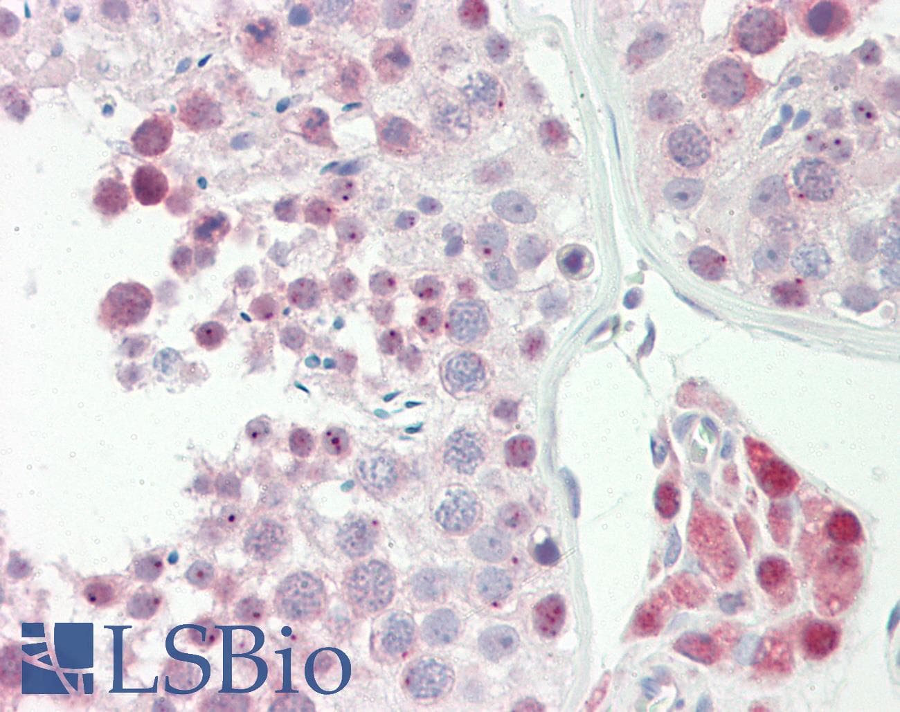 IHC-plus™ SPIN / SPIN1 Antibody (aa111-160)
