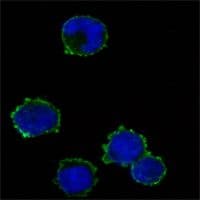 Monoclonal Mouse anti-Human CD247 / CD3 Zeta Antibody (clone 4B10, IHC, IF, WB)