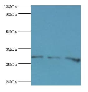 Polyclonal Rabbit anti-Human HOXB5 Antibody (aa1-170, IHC, WB)
