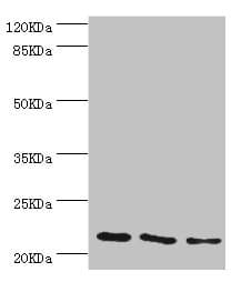 TAGLN2 / Transgelin 2 Antibody