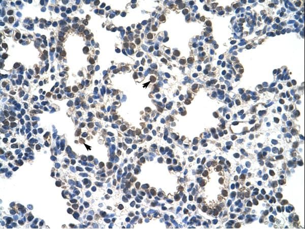 RCOR1 / COREST Antibody (N-Terminus)