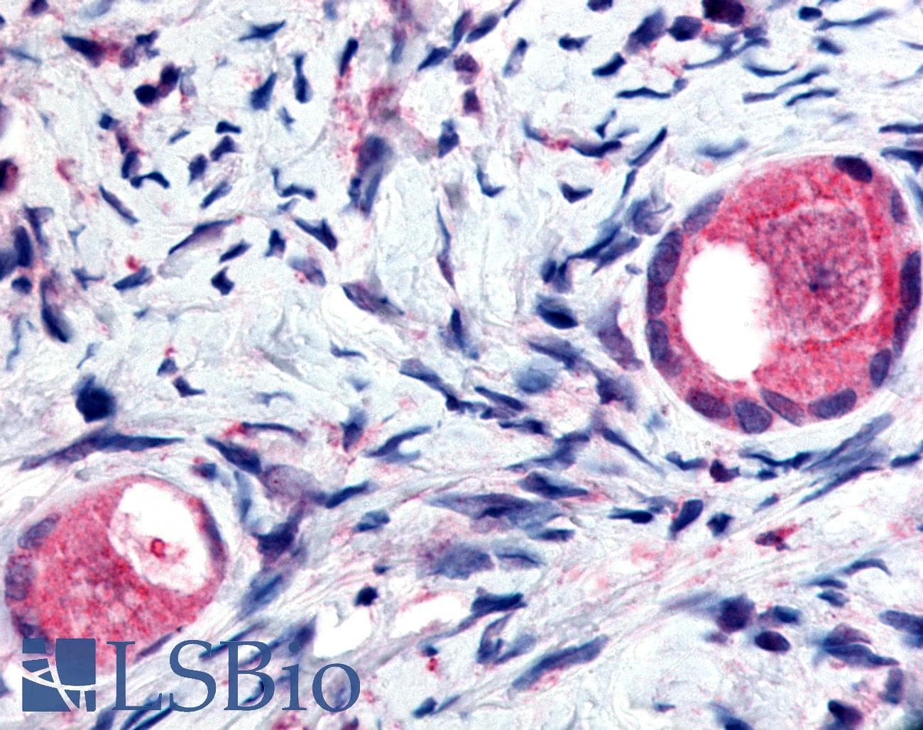 IHC-plus™ Polyclonal Rabbit anti-Human TMEM5 Antibody (Extracellular Domain, IHC)