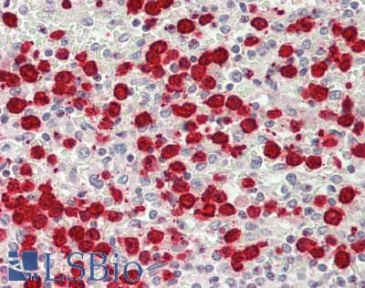 IHC-plus™ Polyclonal Rabbit anti-Human HRS / HGS Antibody (aa461-510, IHC, IF, WB)