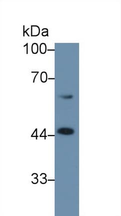 SERPINA6 / CBG Antibody (aa280-405, APC)