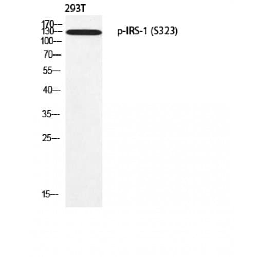 Polyclonal Rabbit anti-Human IRS1 Antibody (260-340 aa, IHC, IF, WB)
