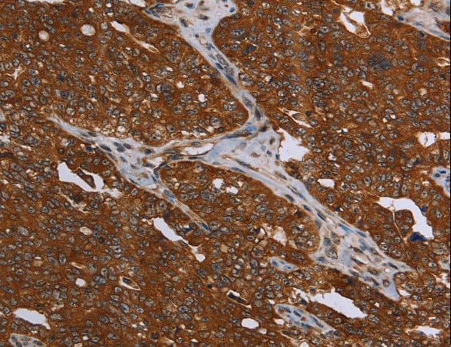 Polyclonal Rabbit anti-Human MCHR1 Antibody (IHC, WB)