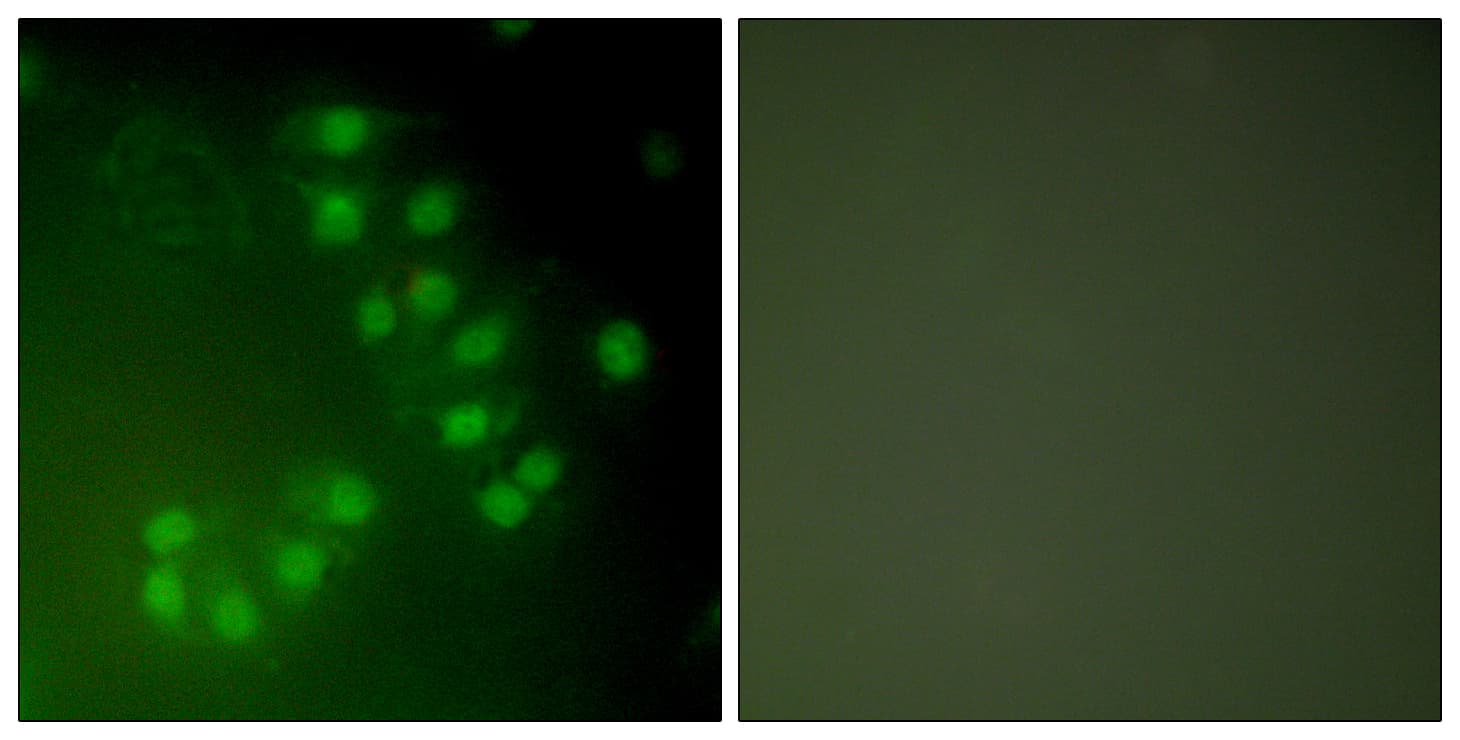 IHC-plus™ TP63 / p63 Antibody (C-Terminus)