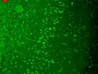 IHC-plus™ TRPM7 Antibody (aa1817-1863, clone S74-25)