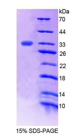 Human FMO2 Protein (Recombinant His-T7)