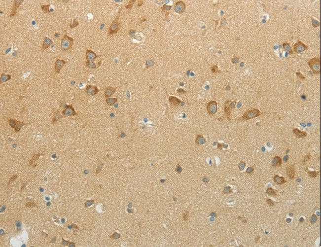NDRG3 Antibody