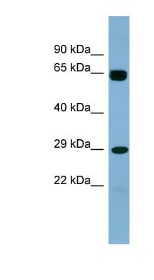 LRRN4CL Antibody (aa107-156)