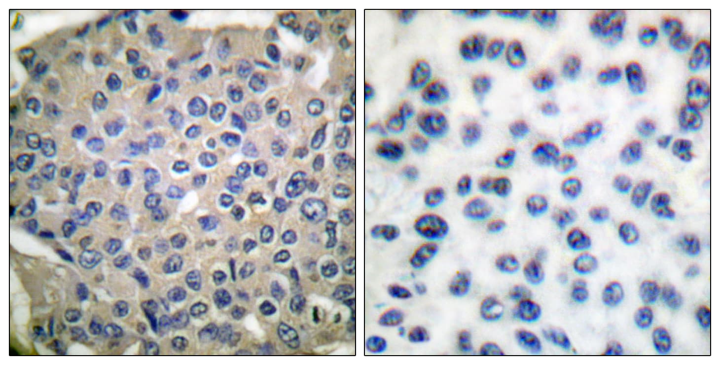 CTTN / Cortactin Antibody (phospho-Tyr466)