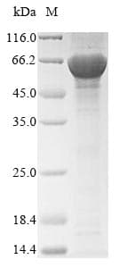 Candida glabrata Acetyl-CoA Carboxylase / ACC Protein (Recombinant 10His, N-terminus)