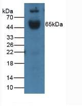 IL1R1 Antibody (aa20-338)