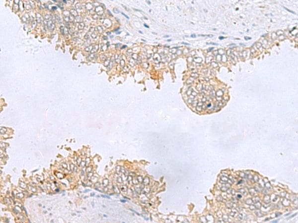Polyclonal Rabbit anti-Human KIAA1434 protein Antibody (IHC, WB)