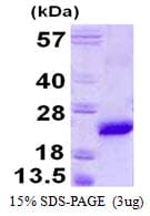 Mouse VPS29 Protein (Recombinant His)