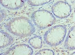 Polyclonal Rabbit anti-Human HYOU1 / ORP150 Antibody (aa1-140, IHC)