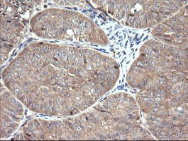 RAB21 Antibody (clone OTI6F11)