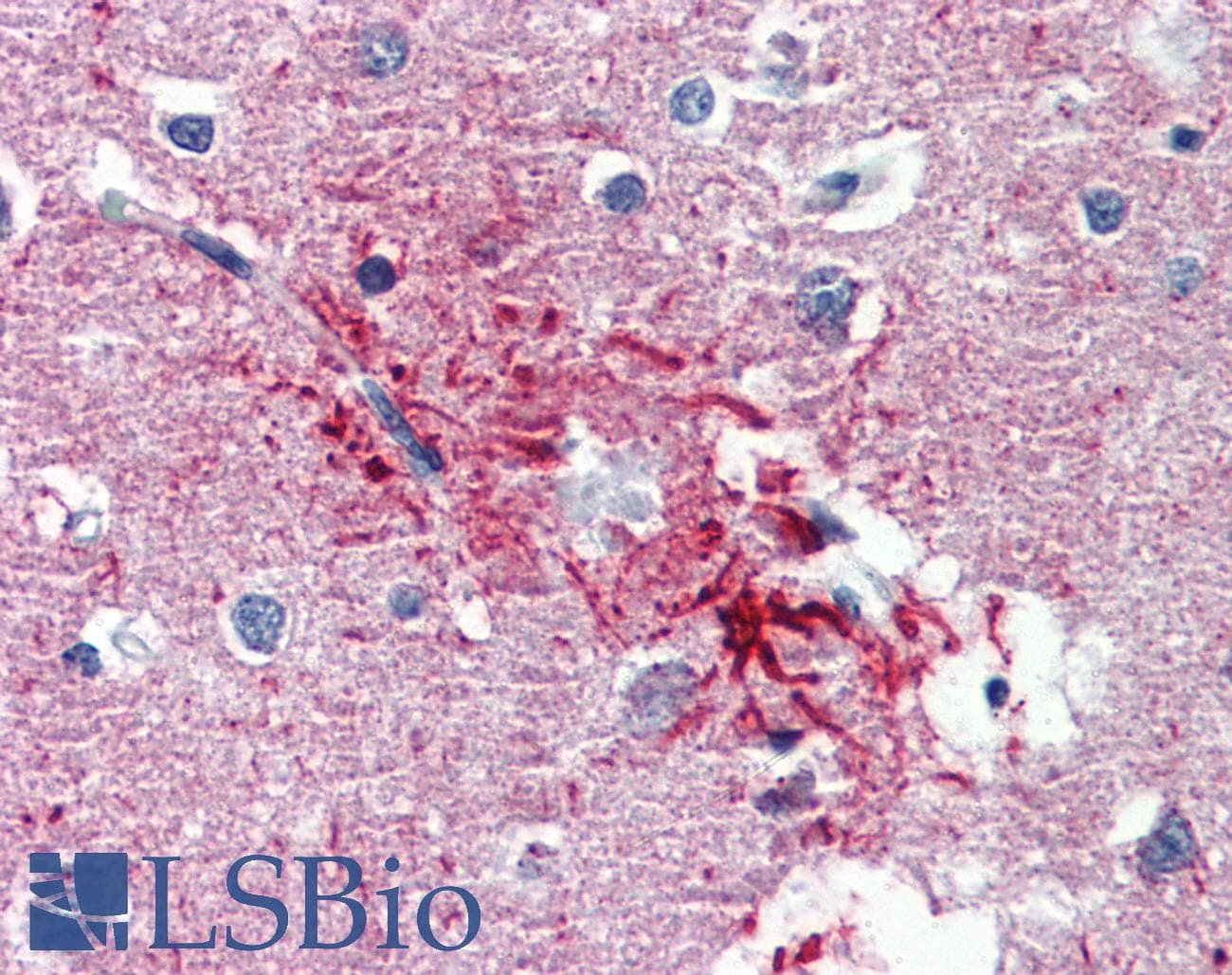 Polyclonal Rabbit anti-Human HMGN1 / HMG14 Antibody (aa36-85, IHC, WB)