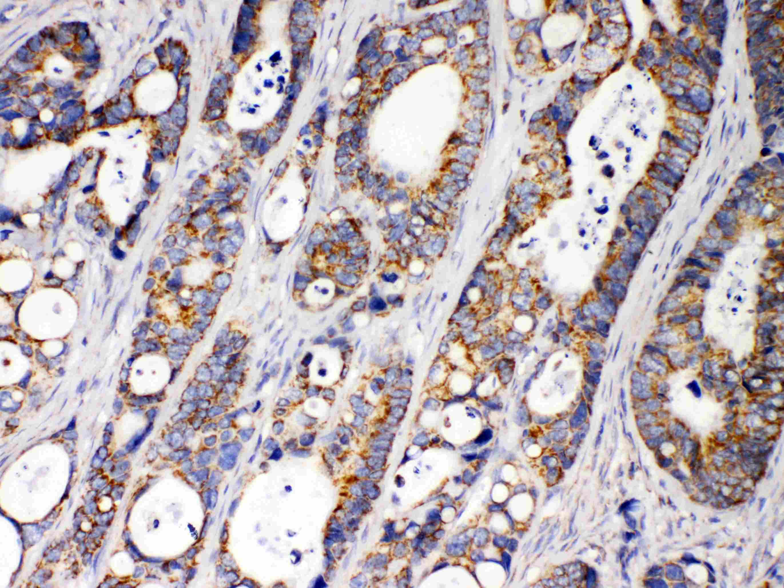 ACAA2 Antibody