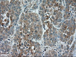 TRPM4 Antibody (clone OTI10H5)