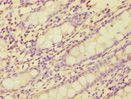 ETK / BMX Antibody (aa65-280)