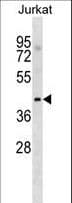 Polyclonal Rabbit anti-Human MGAT / GLYT1 Antibody (aa159-187, WB)