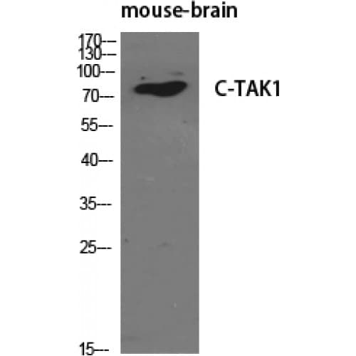 C-TAK1 / MARK3 Antibody (1-80 aa, N-terminal)