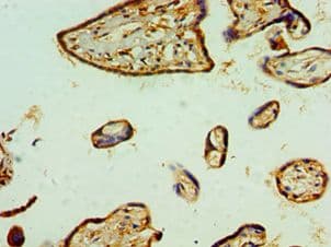 RBX1 / ROC1 Antibody (aa1-108)